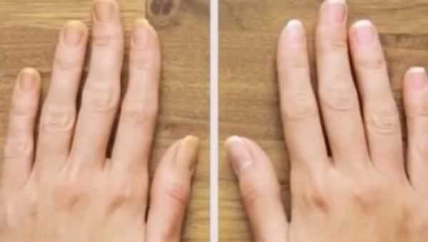 吃了枇杷手怎么洗,吃完枇杷手上黃黃的怎么洗的掉呀圖7