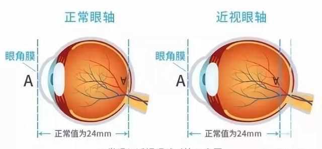 眼鏡可以帶上飛機(jī)嗎，五毫升的隱形眼鏡護(hù)理液可以隨身帶著上飛機(jī)嗎？圖2