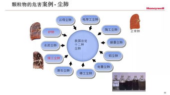放射安全防護(hù)知識ppt