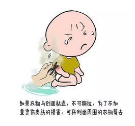 如何預(yù)防燙傷安全知識幼兒園