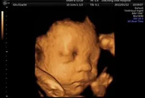 B超單有這個一般是女孩