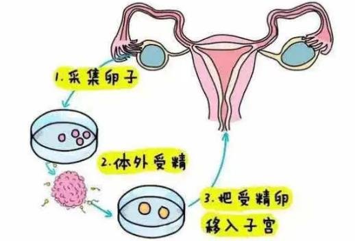 試管嬰兒怎么做的全過程 試管嬰兒怎么做的全過程