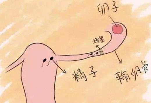 輸卵管堵塞的10個征兆