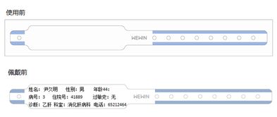 常用識(shí)別患者身份的方法有哪些