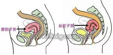 子宮肌瘤止血方法有哪些