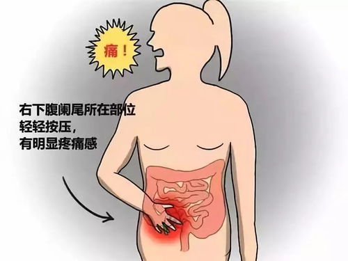 慢性盲腸炎會(huì)引起哪些不適療方法