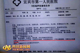 b超檢查報(bào)告單(B超檢查多少錢)