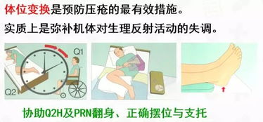 壓瘡的護(hù)理(壓瘡護(hù)理論文)