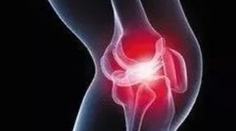 關(guān)節(jié)炎,注意事項(xiàng)