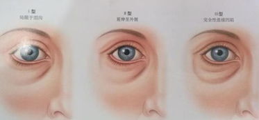 手術后,注意事項,眼睛