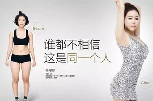 注意事項(xiàng),隆下頦后