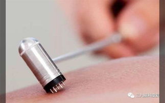 刺絡注意事項