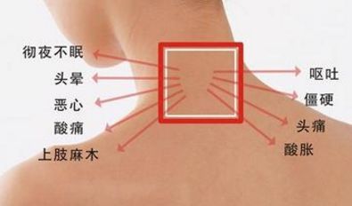 有頸椎病的注意事項