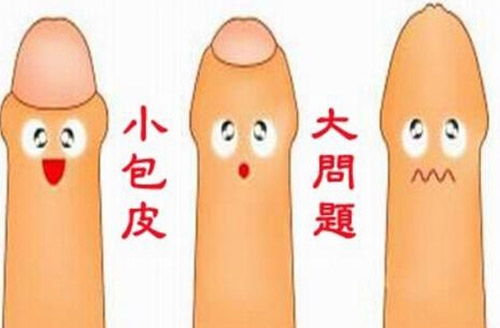 包皮手術取環(huán)注意事項