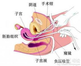吃藥打胎后需要注意什么,藥流后有什么注意事項(xiàng),藥物打胎后注意事項(xiàng)有哪些