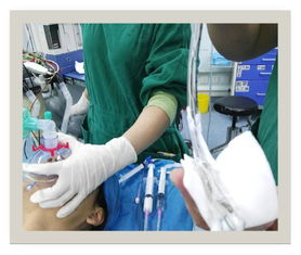 簡(jiǎn)述,氣管,注意事項(xiàng),插管