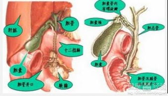 膽腎結(jié)石飲食注意事項(xiàng)