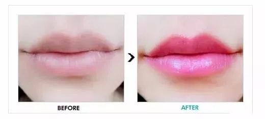 注意事項(xiàng),紋唇后