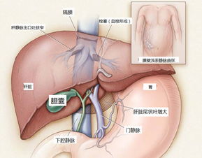 靜脈,注意事項(xiàng),血栓形成