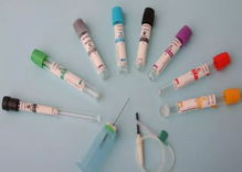 2血標(biāo)本采集的注意事項(xiàng)