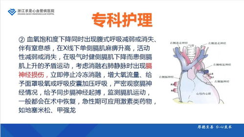 導(dǎo)管消融術(shù)后注意事項