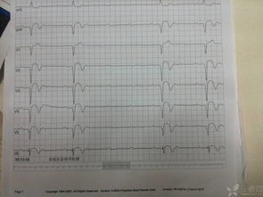 b受體阻滯劑應用注意事項