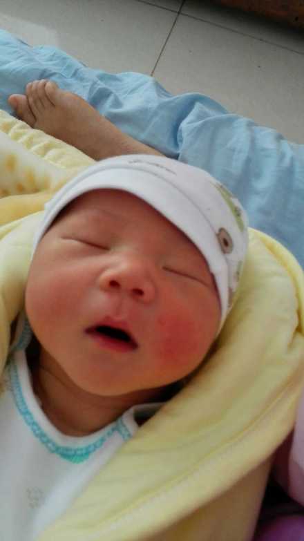 注意事項,破腹產(chǎn)第