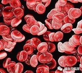 懸浮紅細(xì)胞輸注速度,輸懸浮紅細(xì)胞的速度和注意事項,輸入懸浮紅細(xì)胞注意事項