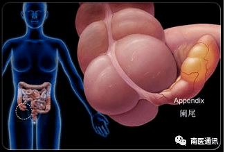 做了闌尾炎手術后要注意什么飲食,闌尾炎微創(chuàng)手術后飲食注意事項,闌尾炎輸液后飲食注意事項