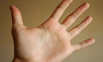 手掌,骨頭,注意事項(xiàng)
