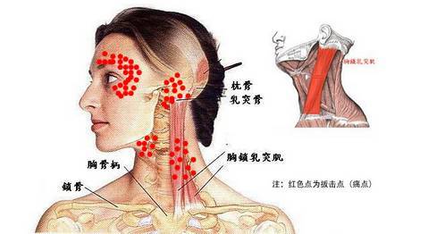 頸椎做完正骨手法后注意事項(xiàng)