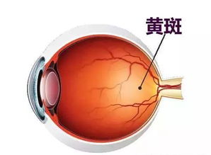 眼睛黃斑水腫注意事項(xiàng)