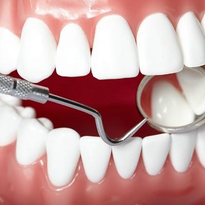 拔牙補(bǔ)牙后的注意事項(xiàng),拔牙補(bǔ)牙注意事項(xiàng)與禁忌癥,拔牙補(bǔ)牙前注意事項(xiàng)