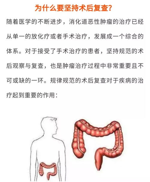 結(jié)腸灌洗的方法和注意事項,中藥全結(jié)腸灌洗注意事項,結(jié)腸esd術(shù)后注意事項