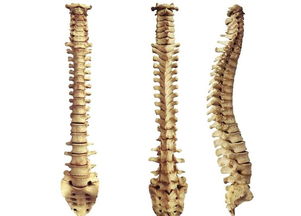 脊柱關(guān)節(jié)病的注意事項(xiàng)