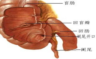 闌尾,人手,術前,注意事項