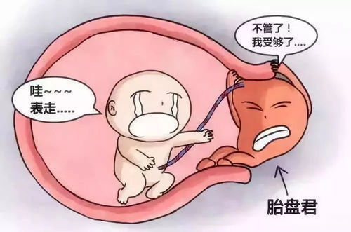 32周胎盤(pán)前置注意事項(xiàng)