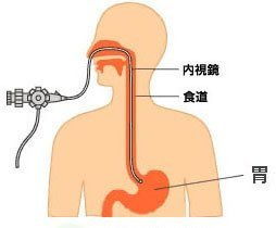 腸鏡胃鏡檢查后飲食注意事項(xiàng),無痛胃鏡檢查后飲食注意事項(xiàng)有哪些方面,胃鏡檢查后飲食需要注意事項(xiàng)
