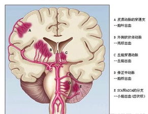 腦出血患者鼻飼注意事項,腦出血昏迷鼻飼注意事項,鼻飼的護(hù)理和注意事項