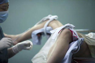 小產(chǎn)以后的注意事項,小產(chǎn)后注意事項和怎樣調(diào)理,冬天小產(chǎn)注意事項