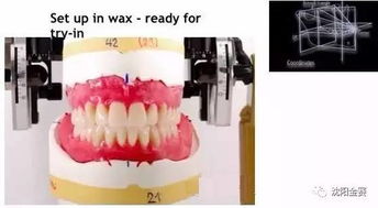 上頜架的注意事項有哪些,上頜架的注意事項中正確的是,上頜架的注意事項中錯誤的是