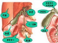 結(jié)石術(shù)后飲食注意事項(xiàng),膽道鏡術(shù)后注意事項(xiàng),膽道結(jié)石飲食注意事項(xiàng)