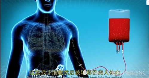 免疫細胞回輸注意事項