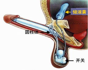 假體隆胸術(shù)后注意事項,假體下巴術(shù)后注意事項,假體下巴術(shù)后注意事項及護(hù)理