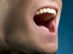 頜關(guān)節(jié)炎注意事項(xiàng)