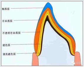 牙體預(yù)備的基礎(chǔ)知識
